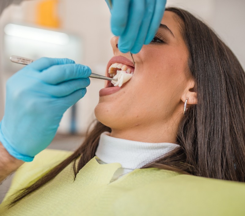 A close-up of a dentist performing a tooth extraction procedure in a clinic in Charles Town, WV